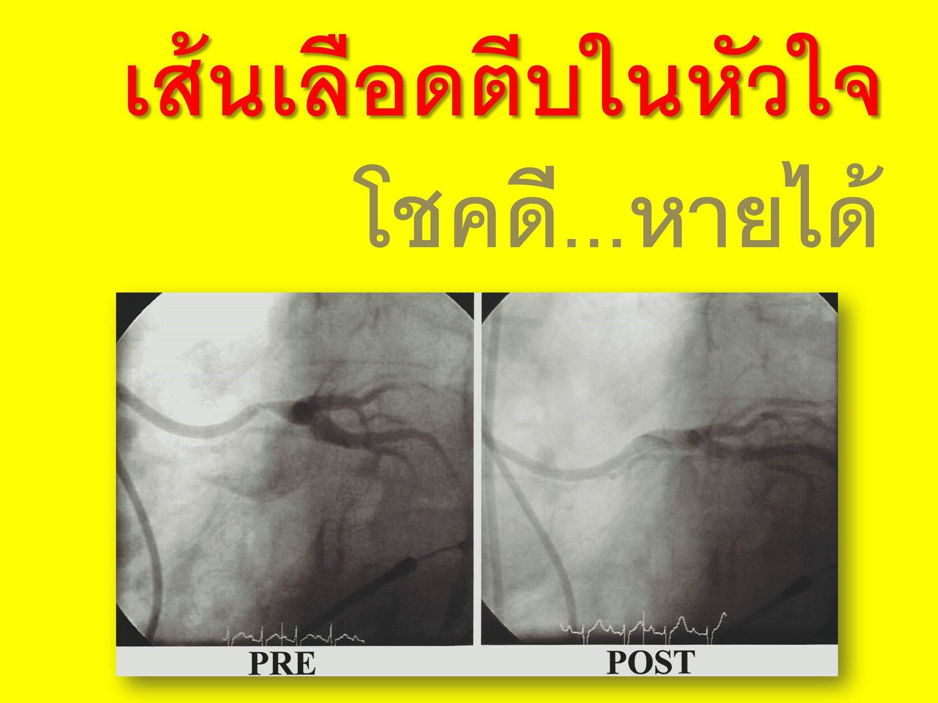 Odoo • A picture with a caption